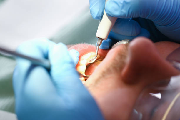 Best Urgent Dental Care for Toothaches in Travilah, MD
