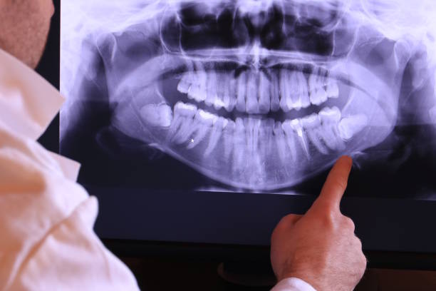 Best Emergency Root Canal Therapy in Travilah, MD