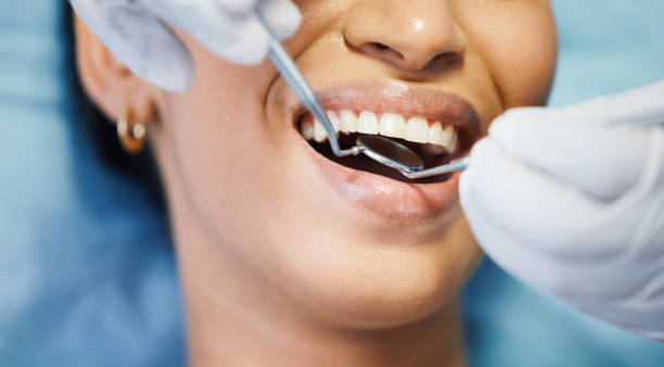 Best Emergency Wisdom Tooth Extraction in Travilah, MD