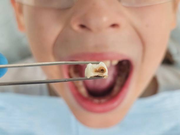 Best Emergency Dental Care for Sports Injuries in Travilah, MD